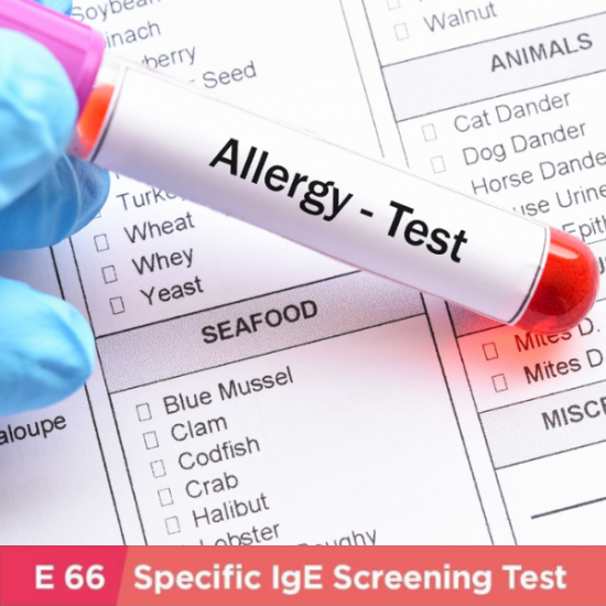 Allergy IgE Test (E66 items)