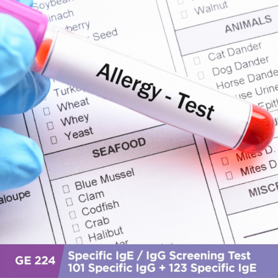 Allergy IgE & IgG Test (GE224 Test)